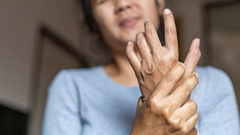 Woman with swollen joints holding a painful wrist