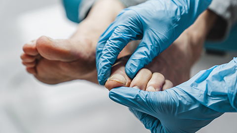 Hands with surgical gloves holding on to a patients foot.