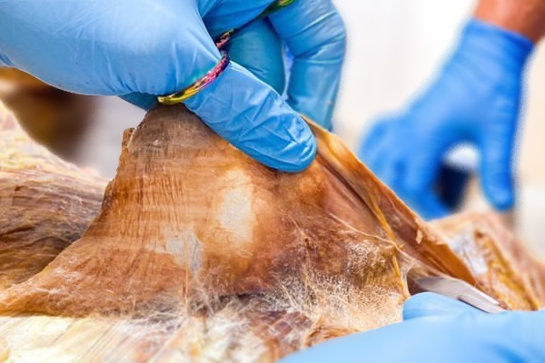 A hand wearing a blue surgical glove holding up a section of human fascia during a dissection.