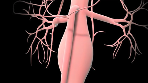 An animated image of an artery set against a black background.