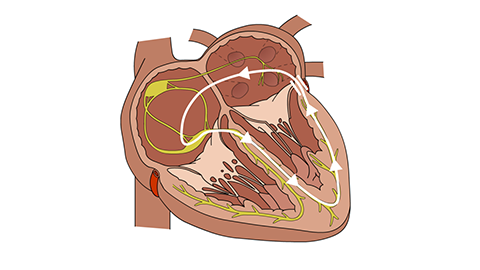 Animated image of the circulation within the aorta.