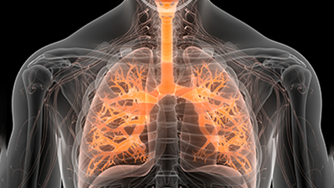 3D image of an X-ray image of lung inflamation.