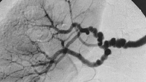 Black and white image of blood vessels under a microscope.