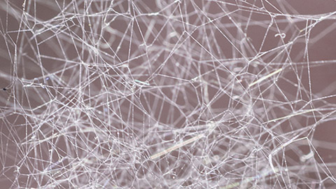 Human fascia shown as a web of sticky, silvery filament. 