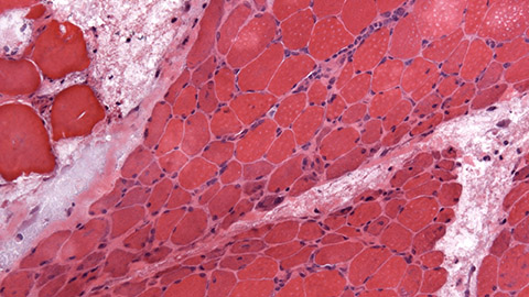 Muscle tissue seen under a microscope